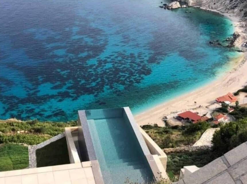 ΥΠΟΒΡΥΧΙΑ ΠΑΡΑΘΥΡΑ